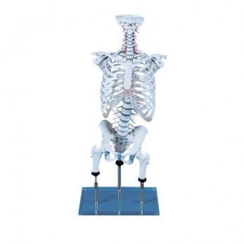 Vertebral Column for Demonstration of Malpositions (acc. to Zilgrei)