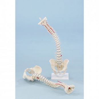 Standard Spine with Prolapse, Pelvis and Stand