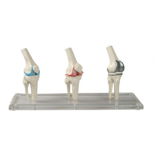 Knee Joint Model
