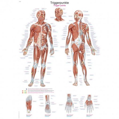Trigger Points on the Body - Poster