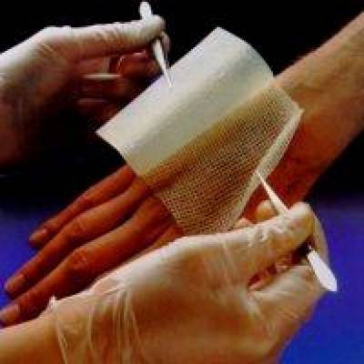 Gauze Dressings